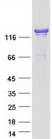 Human ARHGAP45 Protein (Recombinant Myc-DDK (Flag))