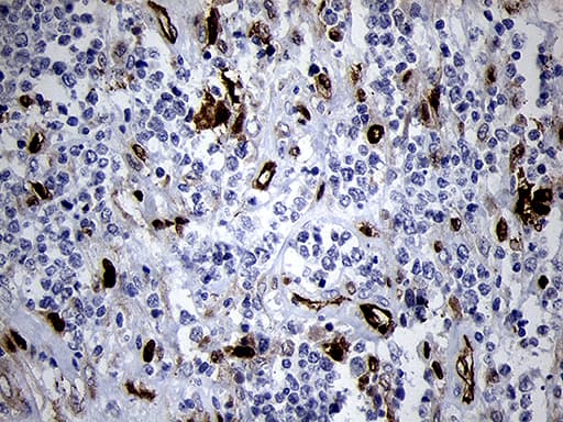 Monoclonal Mouse anti-Human FSCN1 / Fascin Antibody (clone OTI3D2, Carrier-free, IHC, WB)