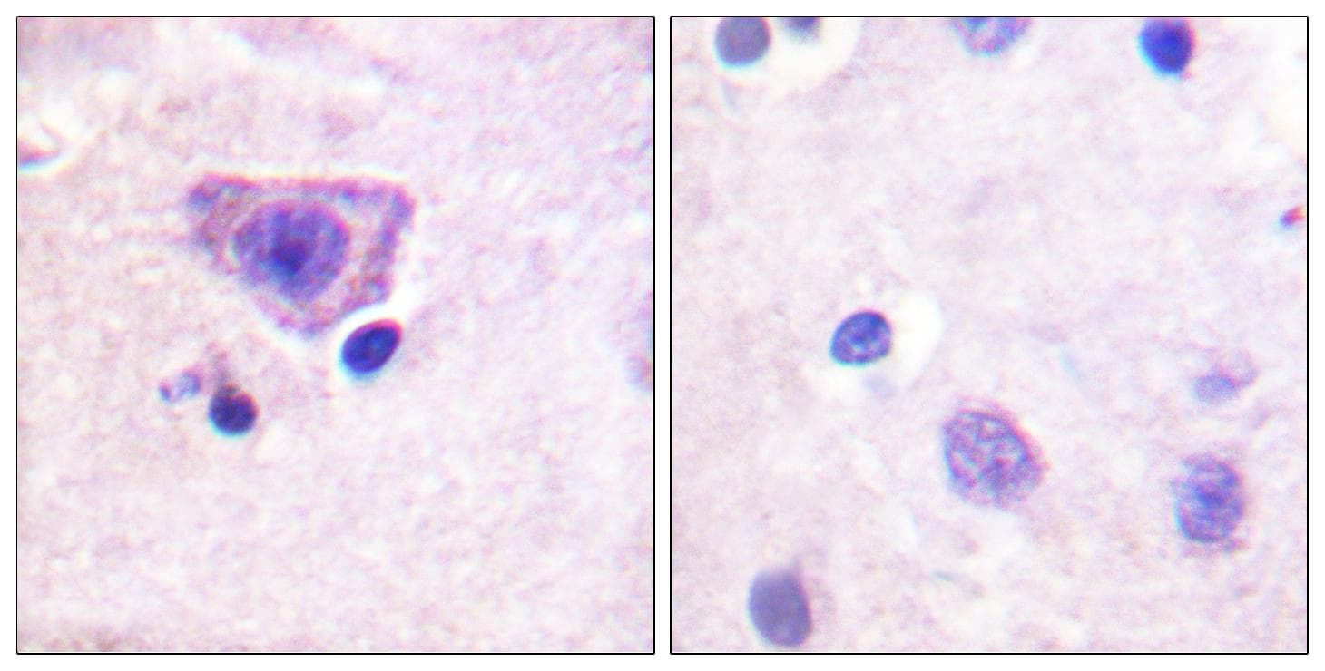 RYR2 / Ryanodine Receptor 2 Antibody (phospho-Ser2808)