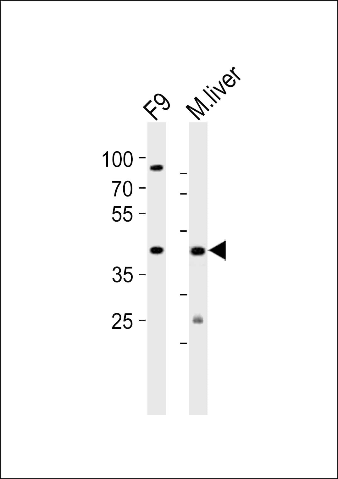 UBTFL1 Antibody (aa186-220)