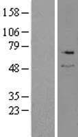 Human SPTLC2 / LCB2 Protein (Over-Expression Lysate Myc-DDK (Flag))