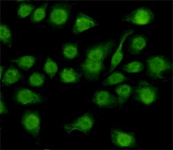 Monoclonal Mouse anti-Human NFI / NFIC Antibody (WB)