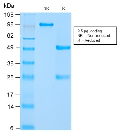HSPD1 / HSP60 Antibody (clone HSPD1/2206R)