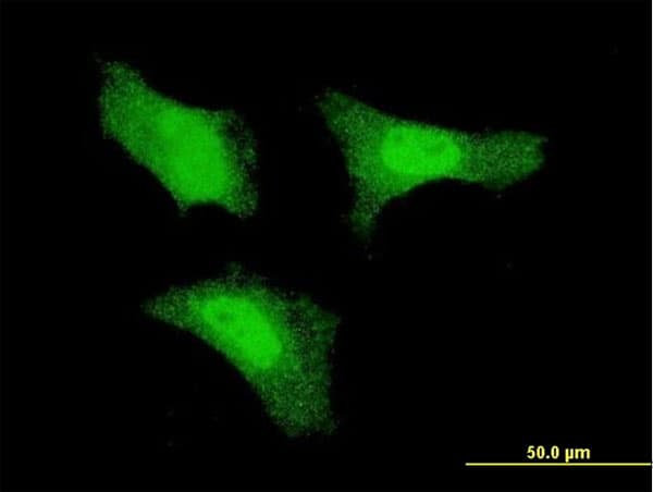 PathPlus™ Monoclonal Mouse anti-Human FGF1 / Acidic FGF Antibody (clone 1F9, IHC, IF, WB)