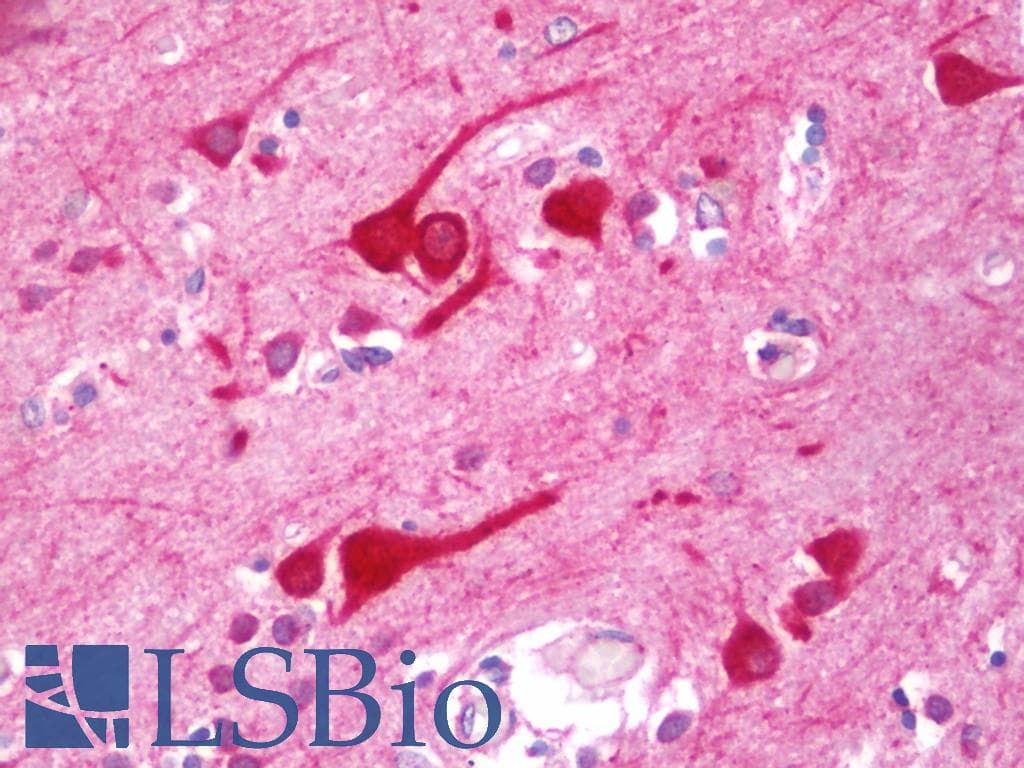 IHC-plus™ Polyclonal Rabbit anti-Human PRAF2 Antibody (aa141-190, IHC, IF, WB)