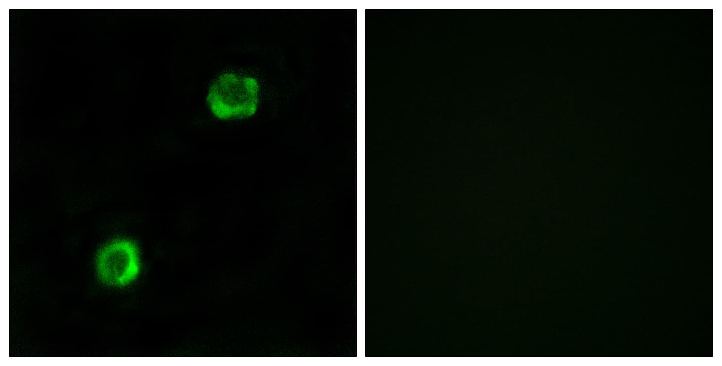 Polyclonal Rabbit anti-Human APOL2 / Apolipoprotein L 2 Antibody (aa191-240, IHC, IF, WB)