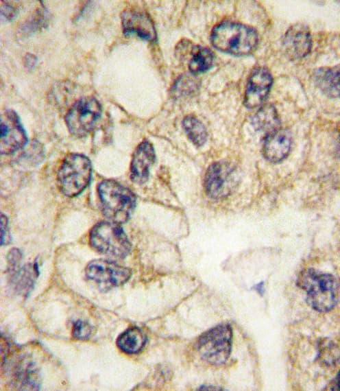 CD14 Antibody (aa292-322)