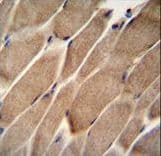ELMO2 Antibody (aa323-350)