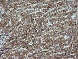 CTNNB1 / Beta Catenin Antibody (clone OTI9C1, Carrier-free)