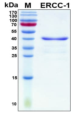 Human ERCC1 Protein (Recombinant His, N-Terminal)