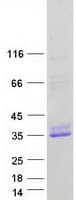 Human DNAJC5 / CSP Protein (Recombinant Myc-DDK (Flag))
