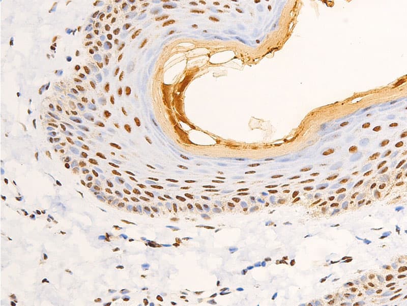 NR3C1/Glucocorticoid Receptor Antibody (phospho-Ser203)