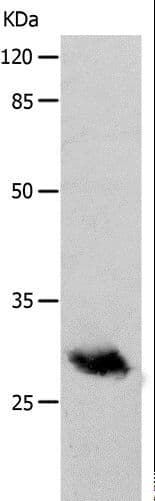 Polyclonal Rabbit anti-Human POMC / Proopiomelanocortin Antibody (WB)