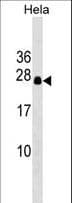 IHC-plus™ DCTN6 / Dynactin 6 Antibody (aa53-80)