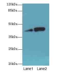 NMUR1 Antibody