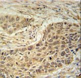 TAF1D Antibody (aa62-90)