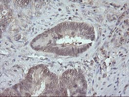 MAP2K3 / MEK3 / MKK3 Antibody (clone OTI5G5)
