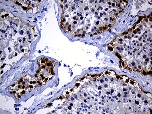 IMP-3 / IGF2BP3 Antibody (clone OTI4H5, Carrier-free)