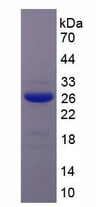 Human GSN / Gelsolin Protein (Recombinant His-T7)