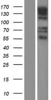 GPR158 Protein (Over-Expression Lysate Myc-DDK (Flag))