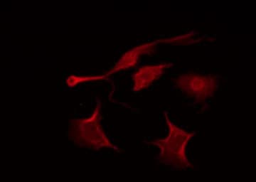 Polyclonal Rabbit anti-Human SRPK3 / MSSK1 Antibody (IF, WB)