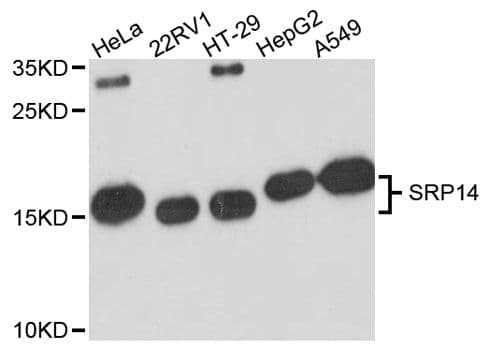 SRP14 Antibody