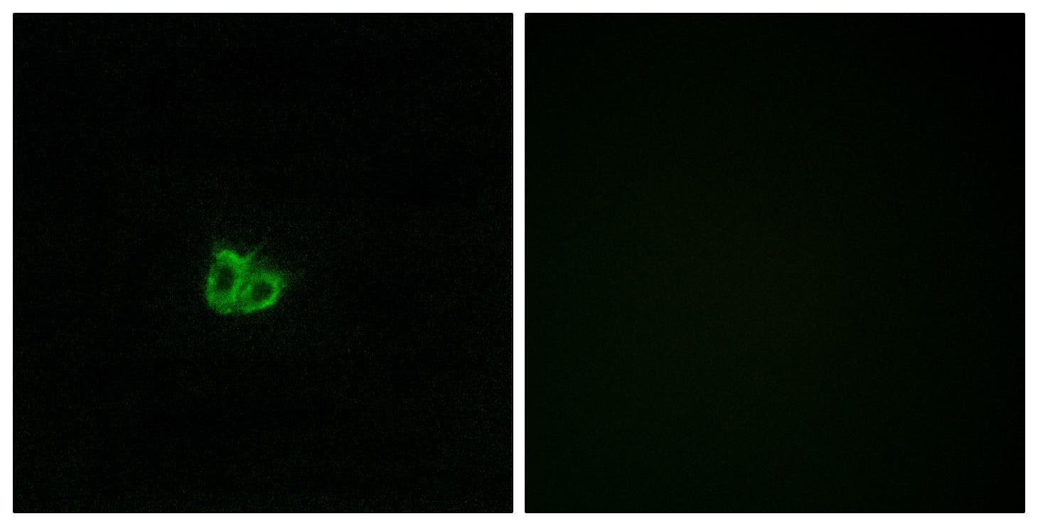 Polyclonal Rabbit anti-Human STMN1 / Stathmin / LAG Antibody (phospho-Ser15, IHC, IF, WB)