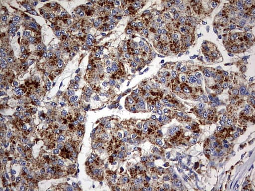 GBA / Glucosidase Beta Acid Antibody (aa40-315, clone OTI1D12)