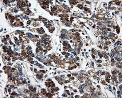 FAHD2A Antibody (clone OTI6D9)