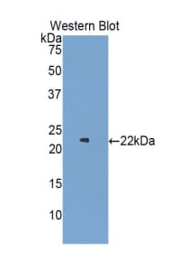 CSF3R / CD114 Antibody (aa655-838)
