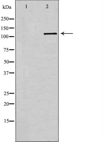 SELPLG / PSGL-1 / CD162 Antibody