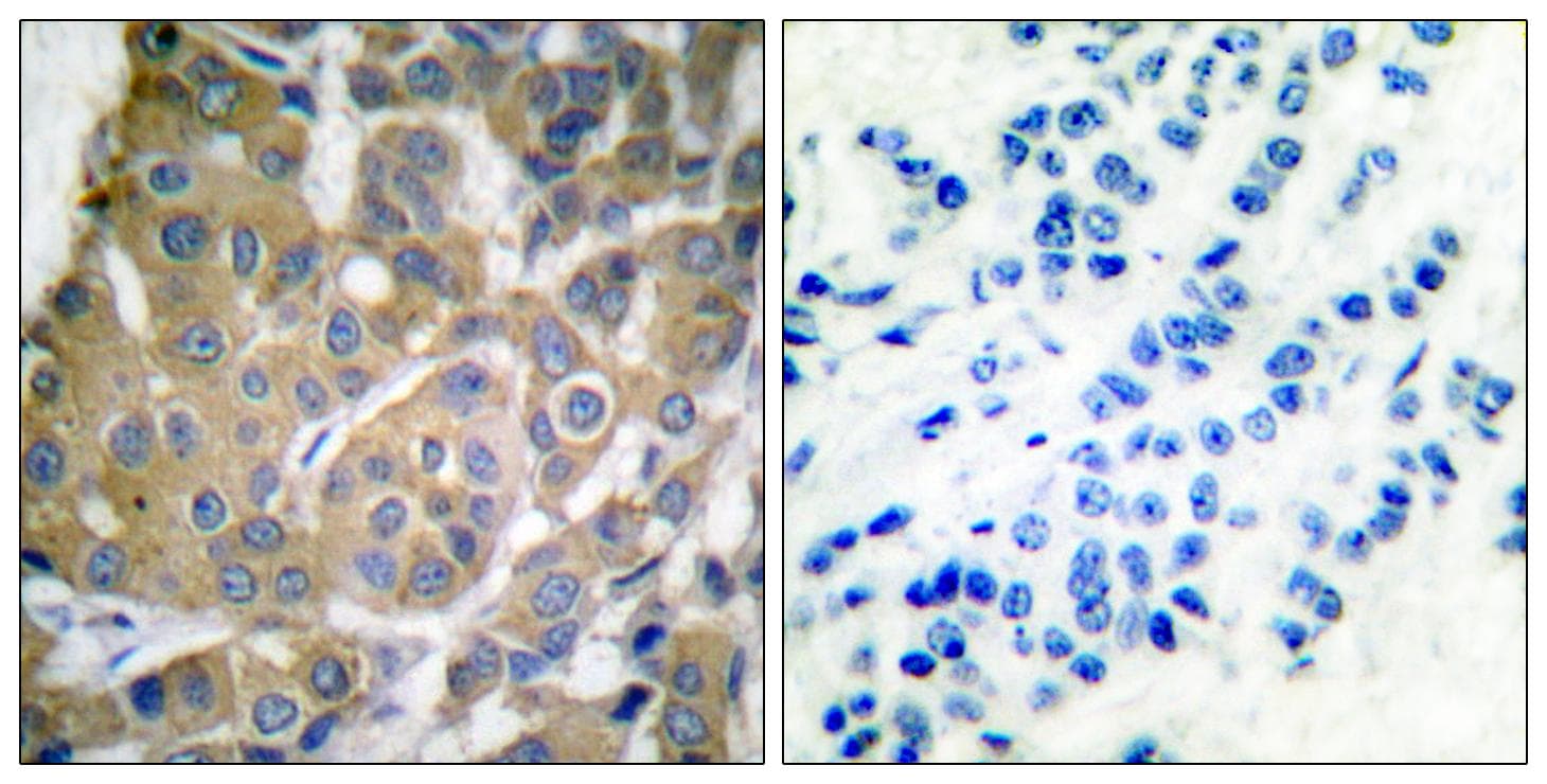 PTGS2 / COX2 / COX-2 Antibody