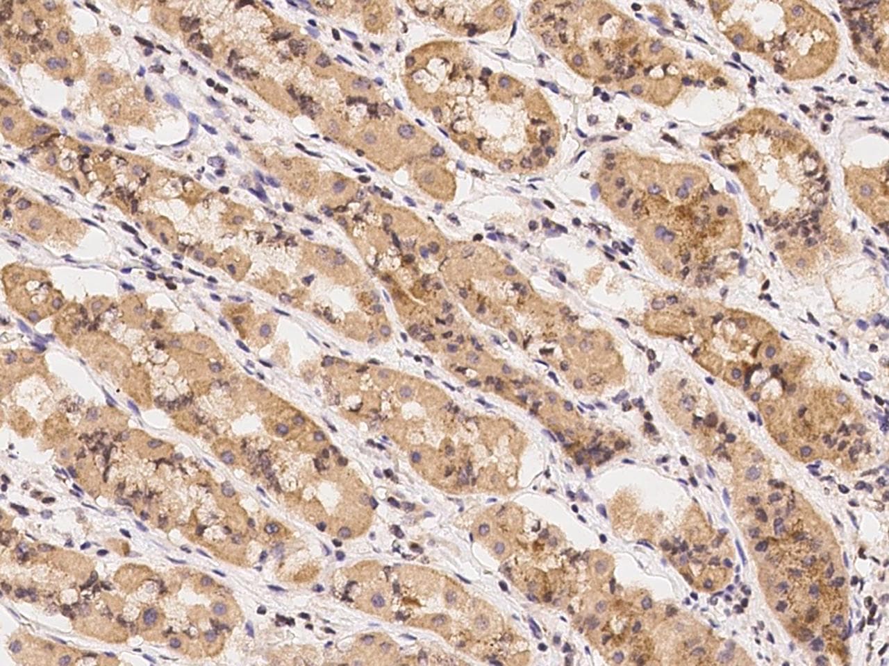 Polyclonal Rabbit anti-Human UROS Antibody (IHC)