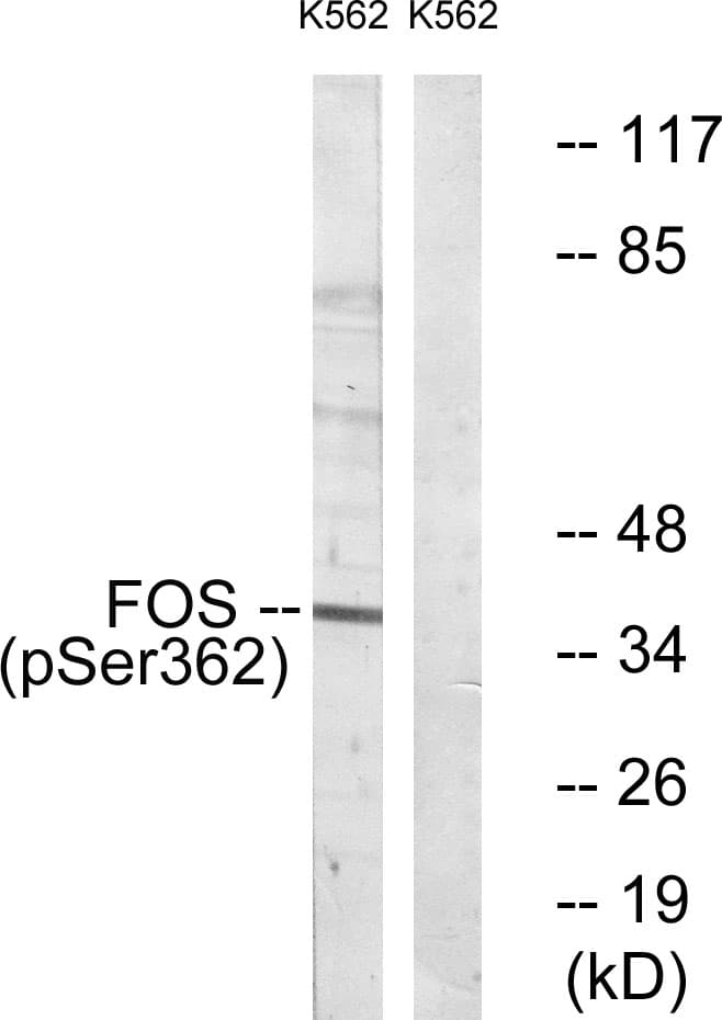 FOS / c-FOS Antibody (phospho-Ser362)