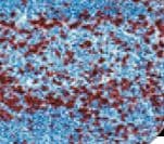 CD45RO Antibody (clone 4KB5, Ready-to-Use)