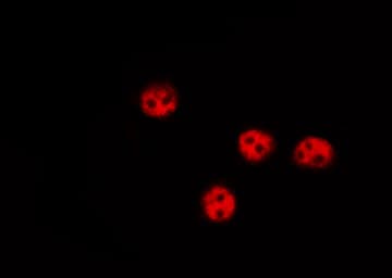 FOXO1 / FKHR Antibody (phospho-Ser319)