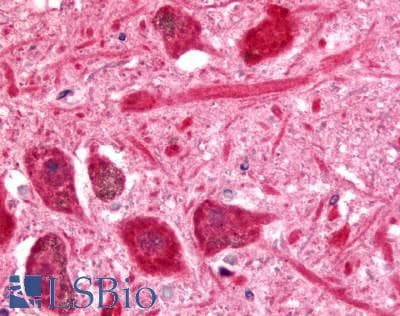 PathPlus™ PACE4 / PCSK6 Antibody (Cytoplasmic Domain)