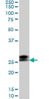 RNF141 Antibody (clone 6D9)