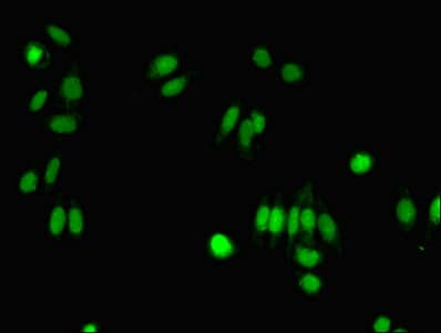 FIBP Antibody (aa2-357)