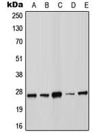 SOCS3 Antibody (Internal)
