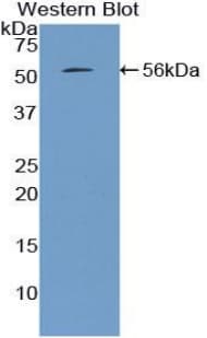 MBL2 / Mannose Binding Protein Antibody (aa19-244)