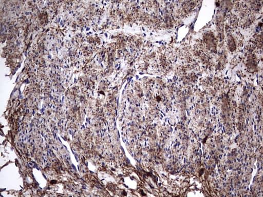 IL1RN Antibody (clone OTI2B1)