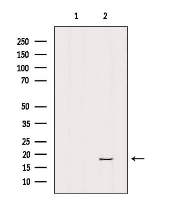 Polyclonal Rabbit anti-Human MRPL23 Antibody (WB)