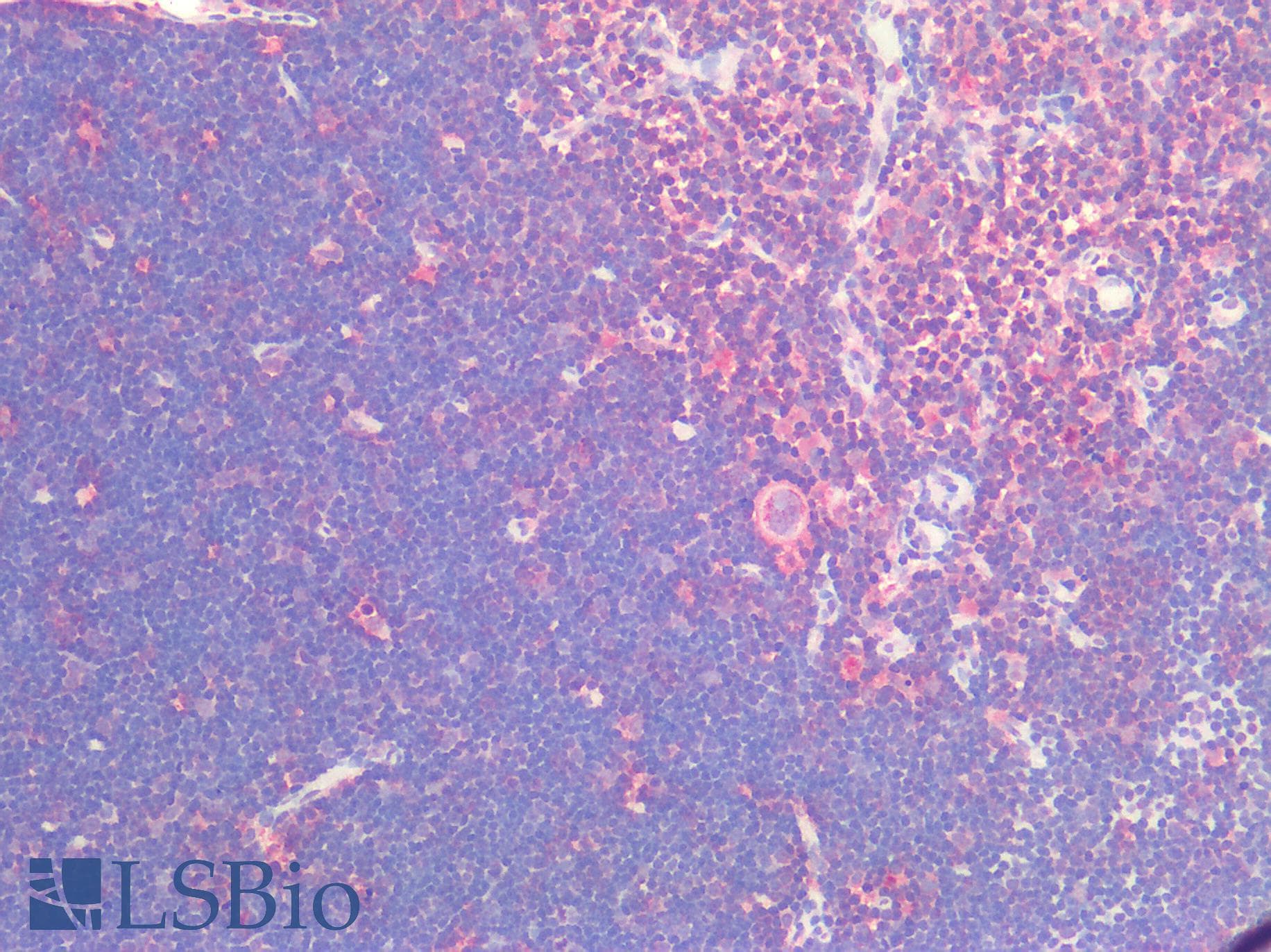 IHC-plus™ TSLP Antibody