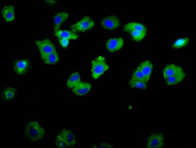 Polyclonal Rabbit anti-Human ASIC1 / ACCN2 Antibody (IF, WB)