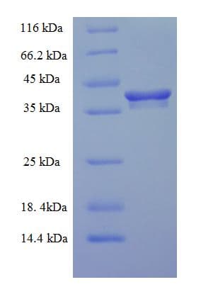 Human EMC9 Protein (Recombinant His-SUMO)