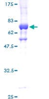 Human STK32C / PKE Protein (Recombinant GST)