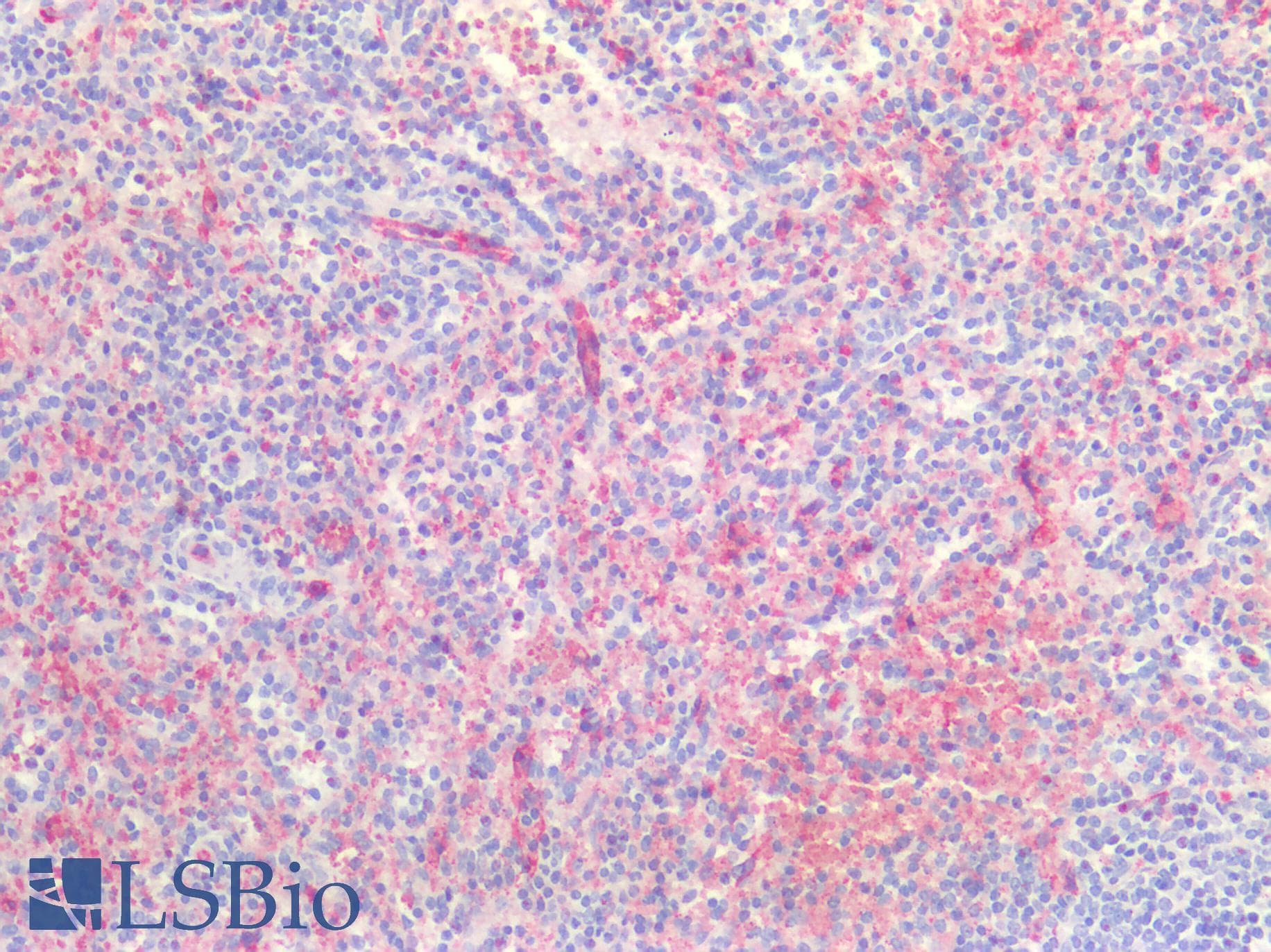 PathPlus™ CLDN5 / Claudin 5 Antibody (aa169-218)