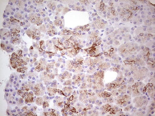 ABCB1 / MDR1 / P Glycoprotein Antibody (aa995-1280, clone OTI8A9)