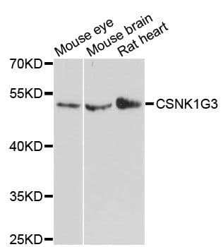 CSNK1G3 / CKI-Gamma 3 Antibody